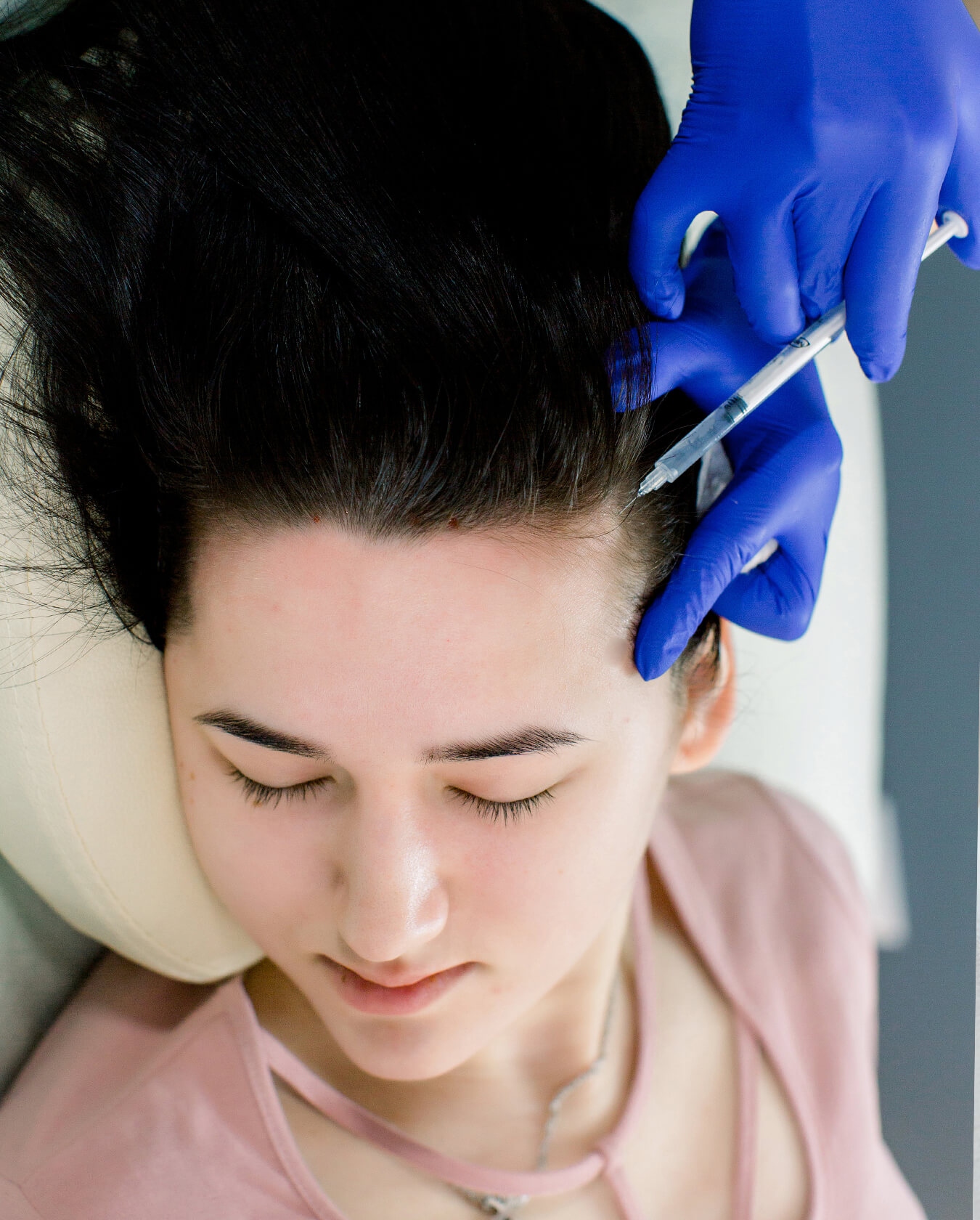 Mesotherapy for Hair Loss